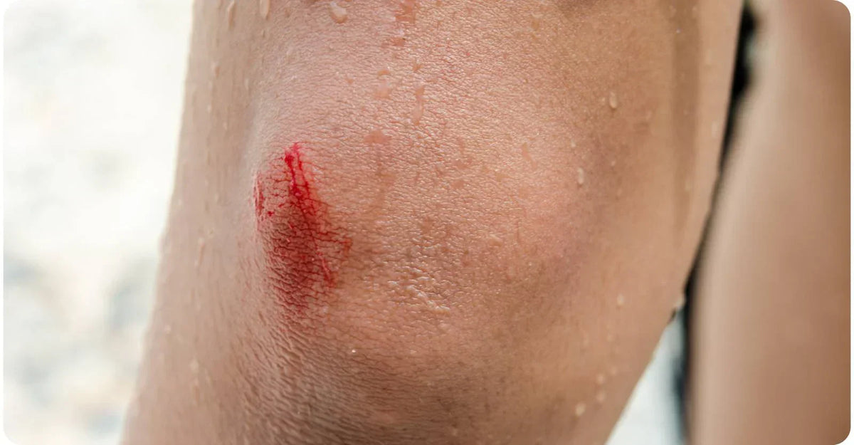 Red Light Therapy For Wound Healing
